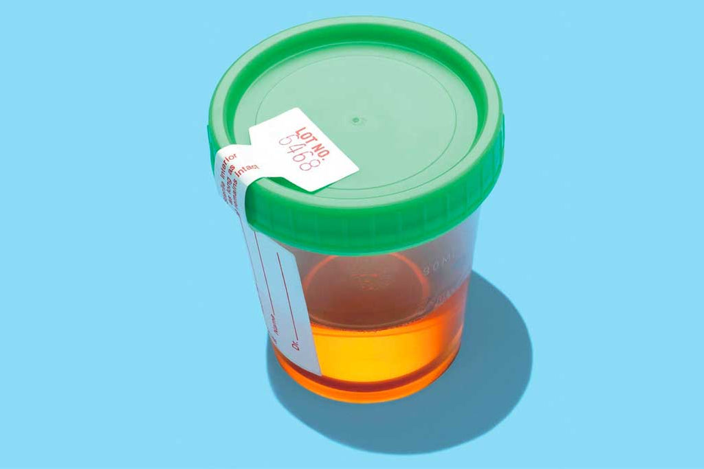 Does CBD Show Up on Drug Tests?